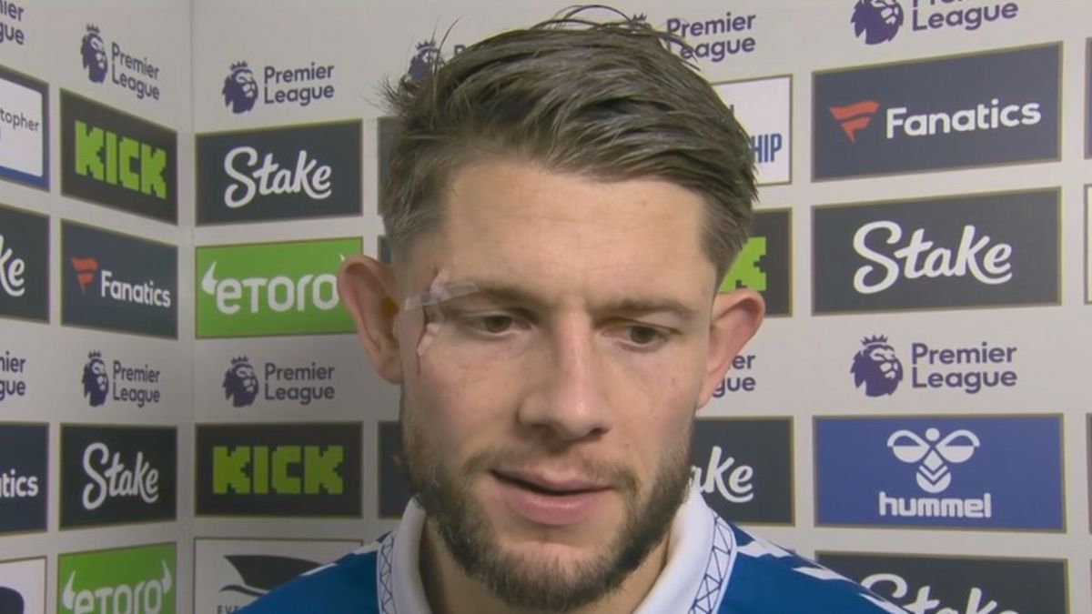 Someone I respected as a legend, but now he is nothing,” Tarkowski said. “He crossed the line and dragged himself into the mud.”